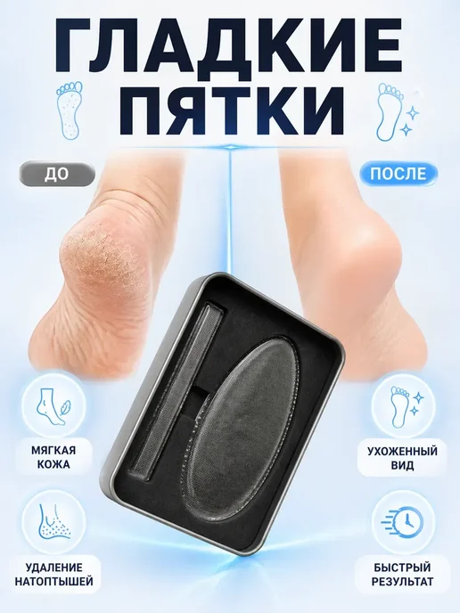 Луи11 Набор для педикюра домашний в металлическом футляре, белый, фото 4