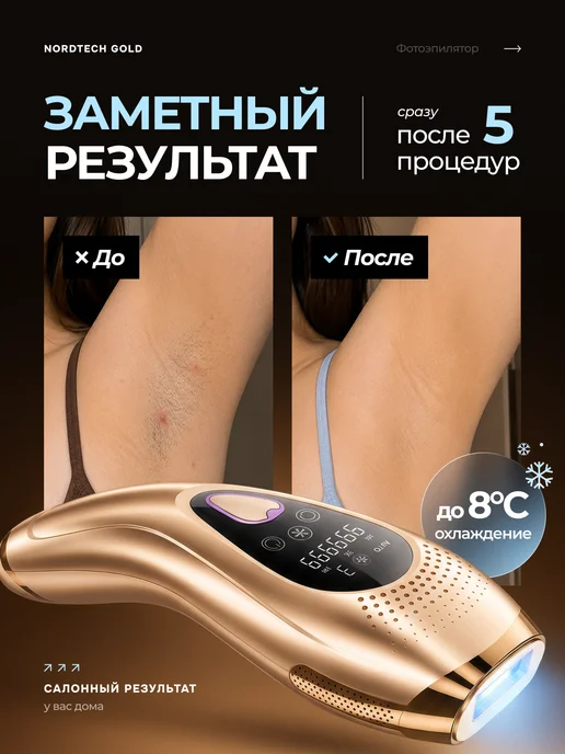 NordTech Фотоэпилятор лазерный, вариант