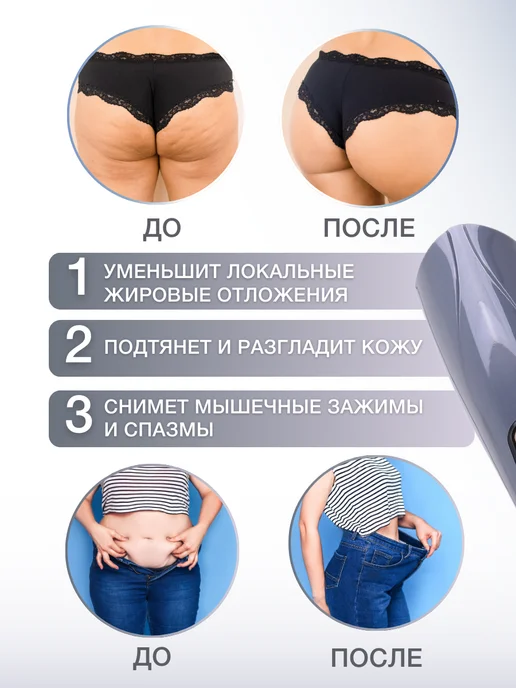 TSOY Массажер электрический для похудения антицеллюлитный, серый, фото 2