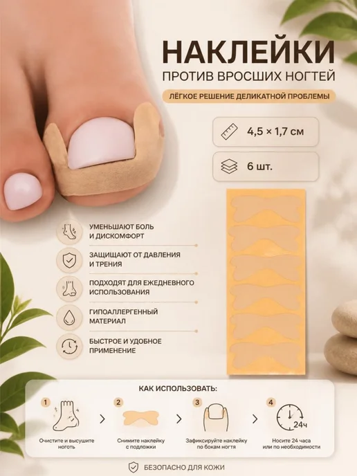 ONLITOP Набор корректоров для вросшего ногтя 6 шт, 6 шт