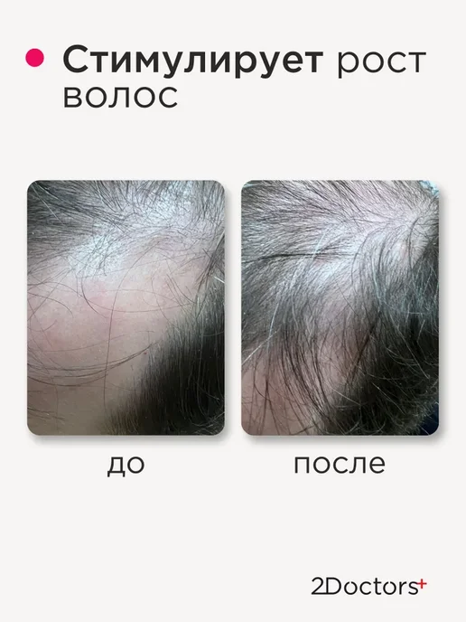 Маска для волос от выпадения и для роста № 37, 2 врача, вариант, фото 7