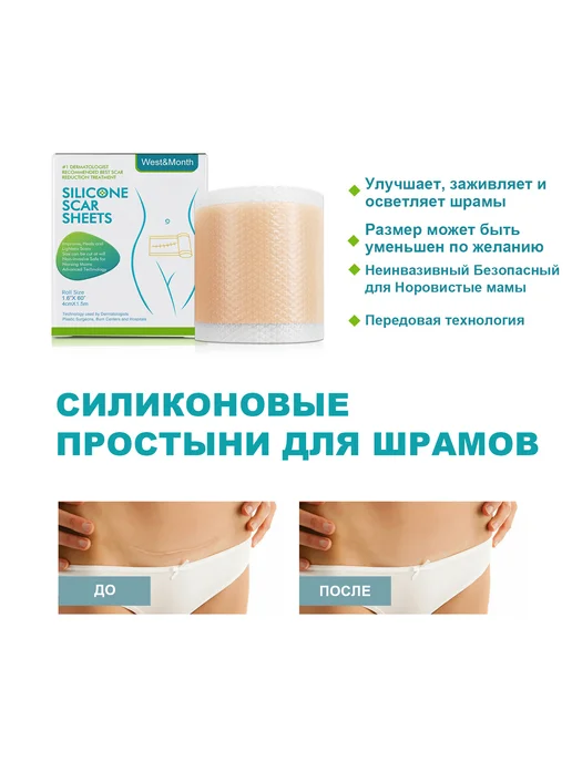 West&Month 2 шт Силиконовые пластыри для выравнивания рельефа кожи, 2 шт, фото 2