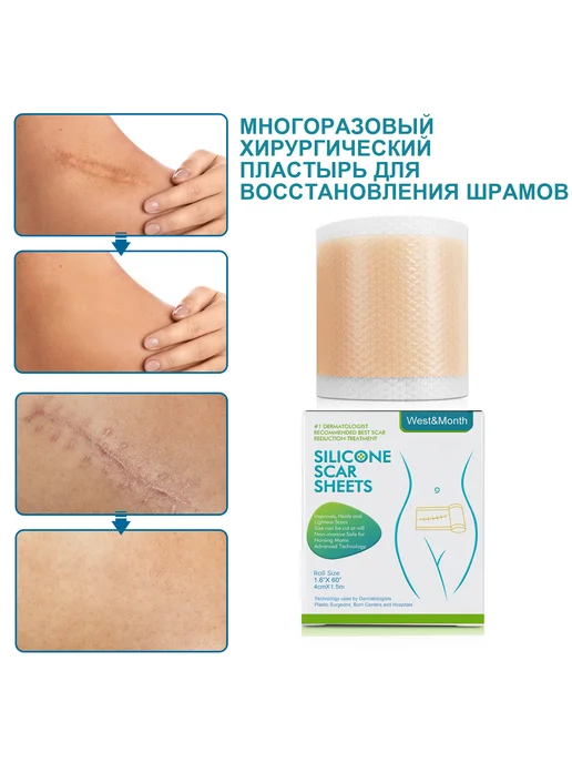 West&Month 2 шт Силиконовые пластыри для выравнивания рельефа кожи, 2 шт, фото 4