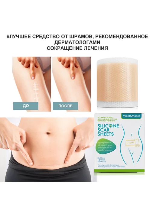 West&Month 2 шт Силиконовые пластыри для выравнивания рельефа кожи, 2 шт, фото 8