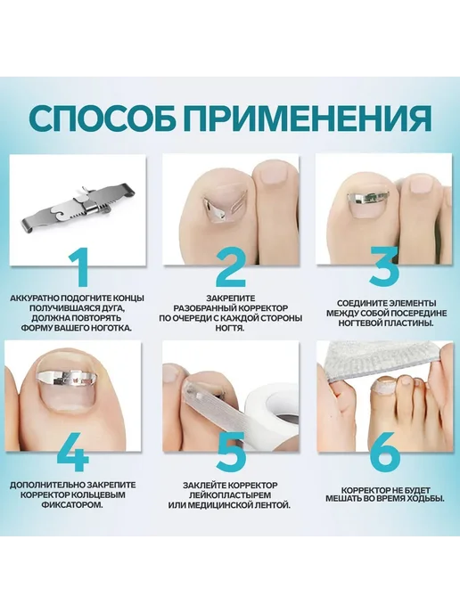 Queen fair Корректор-фиксатор для вросшего ногтя M, серый, фото 2